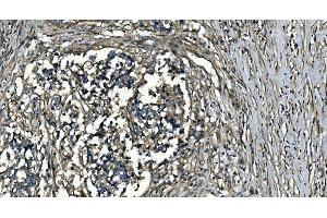 IHC analysis of GNG7 using anti-GNG7 antibody (ABIN7600508).