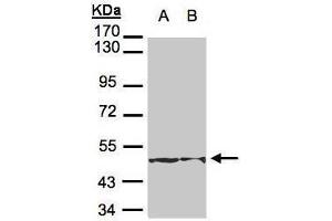 Western Blotting (WB) image for anti-Keratin 18 (KRT18) antibody (ABIN2856142)