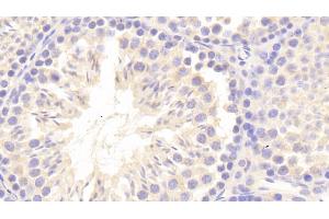 Detection of CRAT in Mouse Testis Tissue using Polyclonal Antibody to Carnitine Acetyltransferase (CRAT) (CRAT antibody  (AA 1-430))