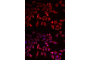 Immunofluorescence analysis of MCF-7 cells using PYGL antibody. (PYGL antibody  (AA 1-280))