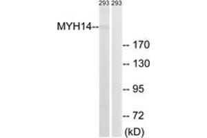 Western blot analysis of extracts from 293 cells, using MYH14 Antibody. (Myosin antibody  (AA 1051-1100))