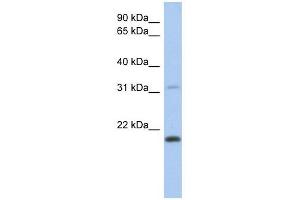 CLECL1 antibody used at 1 ug/ml to detect target protein.