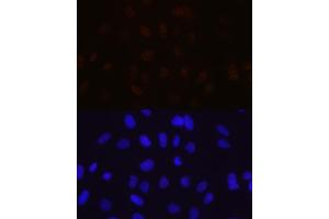 Immunofluorescence analysis of U-2 OS cells using MBNL1 Rabbit mAb (ABIN7268704) at dilution of 1:100 (40x lens). (MBNL1 antibody)