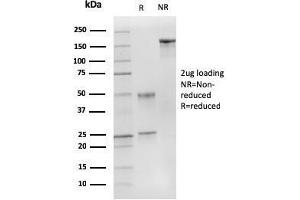 SDS-PAGE Analysis Purified p27 MAb (DCS-72. (CDKN1B antibody)