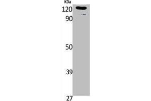 Western Blot analysis of K562, cells using Phospho-Ob-R (Y1141) Polyclonal Antibody