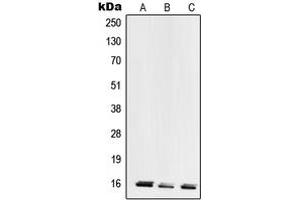 Western blot analysis of RPL28 expression in HeLa (A), MCF7 (B), HEK293 (C) whole cell lysates. (RPL28 antibody  (Center))