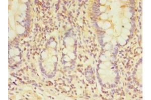 Immunohistochemistry of paraffin-embedded human small intestine tissue using ABIN7172078 at dilution of 1:100 (TARS2 antibody  (AA 369-718))