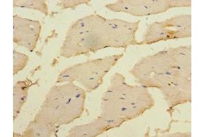 Immunohistochemistry of paraffin-embedded human skeletal muscle tissue using ABIN7150707 at dilution of 1:100 (MAP2K3 antibody  (AA 1-347))