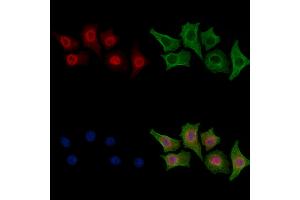 ABIN6258121 and ABIN6275068 staining HepG2 cells by IF/ICC.