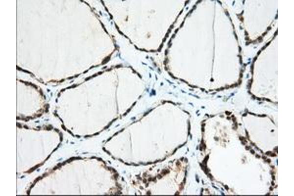 IGF2BP2 antibody