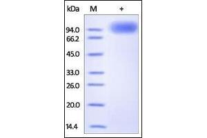 Human TrkB, Fc Tag on SDS-PAGE under reducing (R) condition. (TRKB Protein (AA 32-430) (Fc Tag))