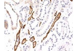 Formalin-fixed, paraffin-embedded human kidney transplant stained with Complement 4d antibody (SPM545). (Complement C4d antibody)
