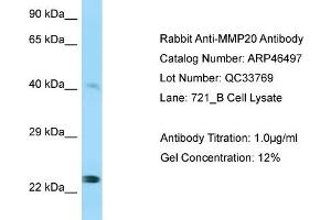 WB Suggested Anti-MMP20 Antibody Titration:  0. (MMP20 antibody  (Middle Region))