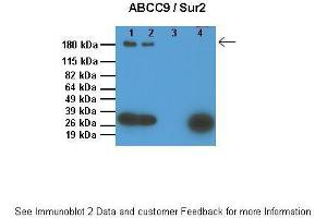 Lanes:   1: 10ug SUR1 KO mouse ventricle lysate, 2: 10ug WT mouse ventricle lysate, 3: 0. (ABCC9 antibody  (Middle Region))