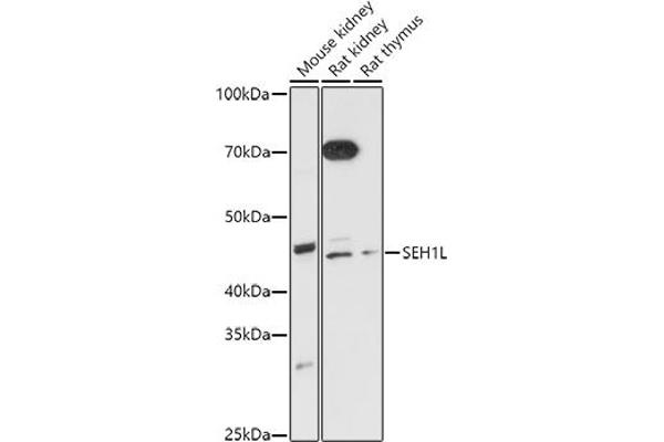 SEH1L antibody