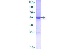 LSM12B Protein (AA 1-195) (GST tag)