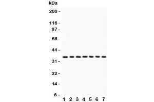 Western blot testing of PP2A antibody and Lane 1:  rat kidney;  2: mouse kidney;  3: human placenta;  4: (r) liver;  5: (m) NIH3T3;  6: (r) PC12;  7: (h) 293T lysate. (PPP2R4 antibody  (AA 1-309))