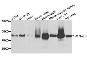 Western blot analysis of extracts of various cell lines, using DYNC1I1 antibody. (DYNC1I1 antibody  (AA 1-220))