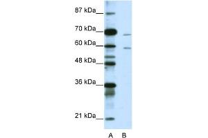 WB Suggested Anti-FOXA2 Antibody Titration:  1. (FOXA2 antibody  (N-Term))
