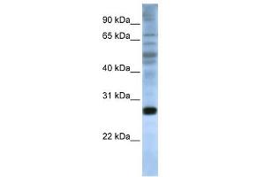EIF4E antibody used at 1 ug/ml to detect target protein. (EIF4E antibody  (C-Term))