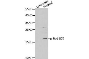 Western Blotting (WB) image for anti-BCL2-Associated Agonist of Cell Death (BAD) (pSer75) antibody (ABIN1870003) (BAD antibody  (pSer75))