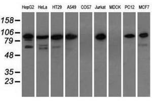 Image no. 3 for anti-Transforming, Acidic Coiled-Coil Containing Protein 3 (TACC3) antibody (ABIN1498100) (TACC3 antibody)