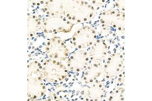 Immunohistochemistry of paraffin embedded rat kidney using NPEPL1 (ABIN7073185) at dilution of 1:100 (400x lens) (BIVM antibody)