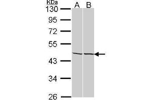 WB Image Sample (30 ug of whole cell lysate) A: A431 , B: Hep G2 , 10% SDS PAGE adenosine kinase antibody antibody diluted at 1:1000
