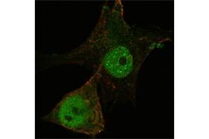 Confocal immunofluorescence analysis of PANC-1 cells using FOXP3 mouse mAb (green). (FOXP3 antibody)