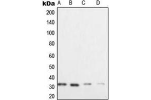 Western blot analysis of XRCC2 expression in HeLa (A), Raji (B), SW480 (C), Caco2 (D) whole cell lysates. (XRCC2 antibody  (C-Term))