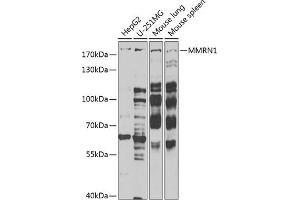 Western blot analysis of extracts of various cell lines, using MMRN1 Antibody (ABIN6129053, ABIN6143926, ABIN6143927 and ABIN6222357) at 1:1000 dilution. (Multimerin 1 antibody  (AA 949-1228))
