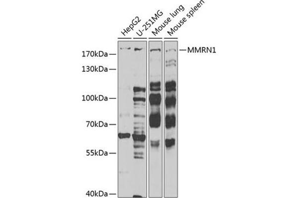 Multimerin 1 antibody  (AA 949-1228)