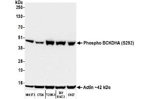 Western Blotting (WB) image for anti-Branched Chain Keto Acid Dehydrogenase E1, alpha Polypeptide (BCKDHA) (pSer292) antibody (ABIN7795621)