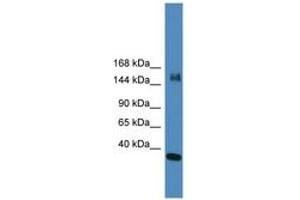 Image no. 1 for anti-Lysine (K)-Specific Demethylase 6A (KDM6A) (N-Term) antibody (ABIN6745346) (KDM6A antibody  (N-Term))