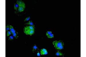 Immunofluorescent analysis of MCF-7 cells using ABIN7151778 at dilution of 1:100 and Alexa Fluor 488-congugated AffiniPure Goat Anti-Rabbit IgG(H+L) (ELMO3 antibody  (AA 464-596))