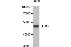 Western blot analysis of extracts of H460 cells, using LHX2 antibody (ABIN5998134) at 1/1000 dilution. (LHX2 antibody)