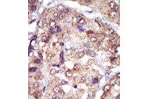 Image no. 2 for anti-V-Yes-1 Yamaguchi Sarcoma Viral Related Oncogene Homolog (LYN) (N-Term) antibody (ABIN359987) (LYN antibody  (N-Term))