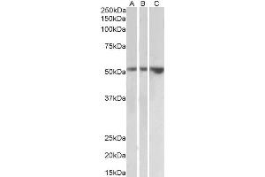 ABIN2613489 (2µg/ml) staining of Kidney (A), Testis (B) and Uterus (C) lysates (35µg protein in RIPA buffer). (HAVCR1 antibody  (Internal Region))