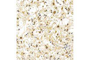 Immunohistochemistry of paraffin embedded mouse placenta using Skar (ABIN7074970) at dilution of 1:900 (400x lens) (p46 antibody)