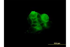 Immunofluorescence of monoclonal antibody to RDX on A-431 cell. (Radixin antibody  (AA 1-583))