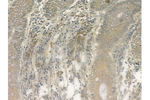 ABIN6264244 and ABIN6269328 at 1/100 staining human normal colon tissue by IHC-P. (PKC delta antibody  (C-Term))