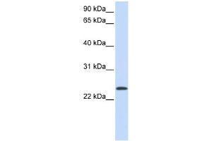 Sample Type: 1. (ARF1 antibody  (Middle Region))