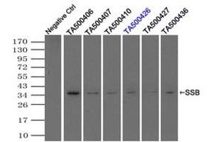 Image no. 2 for anti-Sjogren Syndrome Antigen B (SSB) antibody (ABIN1501146) (SSB antibody)