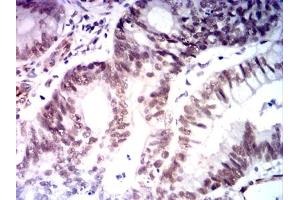 Immunohistochemistry (IHC) image for anti-MutL Homolog 1 (MLH1) (AA 381-483) antibody (ABIN7193587)