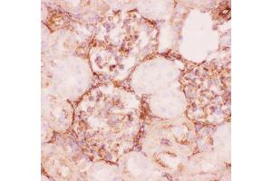 Anti-P Glycoprotein Picoband antibody,  IHC(F): Rat Kidney Tissue (ABCB1 antibody  (Middle Region))