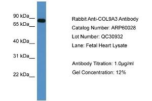 WB Suggested Anti-COL9A3  Antibody Titration: 0.