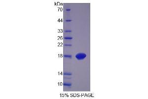 SDS-PAGE analysis of Human MCEE Protein.