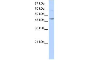 IKZF3 antibody used at 0. (IKZF3 antibody  (N-Term))