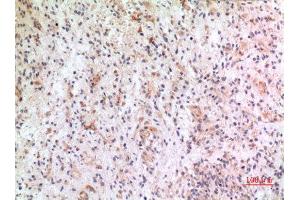 Immunohistochemistry (IHC) analysis of paraffin-embedded Human Brain, antibody was diluted at 1:100. (CX3CL1 antibody  (Internal Region))