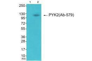 Western blot analysis of extracts from 3T3 cells (Lane 2), using PYK2 (Ab-579) antiobdy. (PTK2B antibody  (Tyr579))